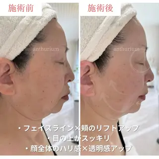 毛穴ケア専門サロンアンスリウム所属・茨城土浦 つくば毛穴 ケア専門サロンのエステ・リラクイメージ