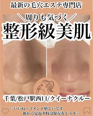 毛穴改善/脱毛 ネイル　川上久仁子のエステ・リラクイメージ