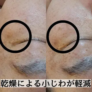 DeRiii 毛穴・ 保湿ケアまつ毛パーマのエステ・リラクイメージ