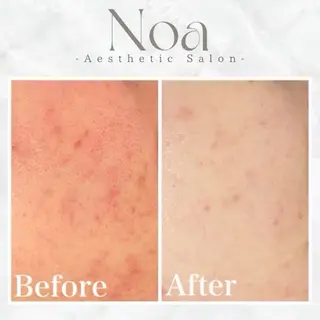 肌質改善サロン Noaのエステ・リラクイメージ