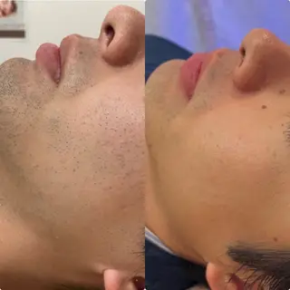 メンズ Cerise La La(スリーズララ)所属・まつ毛パーマ×脱毛 スリーズララ🌼の眉毛・アイブロウイメージ