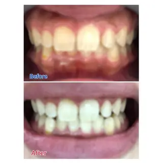 Ｍ渋谷 ホワイトニングのエステ・リラクイメージ