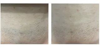 RIKKA☆脱毛/ アイブロウ/メイクの眉毛・アイブロウイメージ