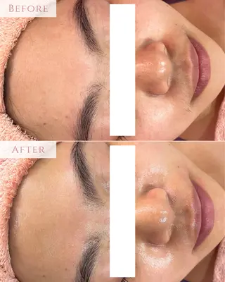 肌質改善専門サロン Bellmi/心斎橋のエステ・リラクイメージ