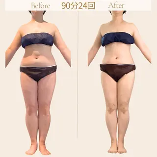 むくみ専門痩身 マクイエステティックのエステ・リラクイメージ