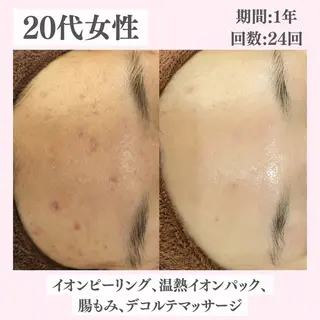ニキビ・肌質改善専門 ♡人生が変わるサロンのエステ・リラクイメージ