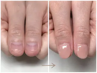 ネイル 深爪矯正・自爪育成 ヴェールリムのネイルデザイン