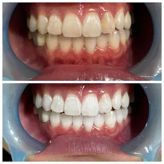 ホワイトニング専門店 Hi-Whiteのその他イメージ