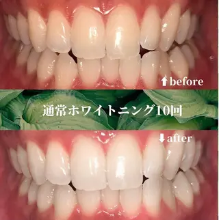 futaba ホワイトニング/天神のエステ・リラクイメージ