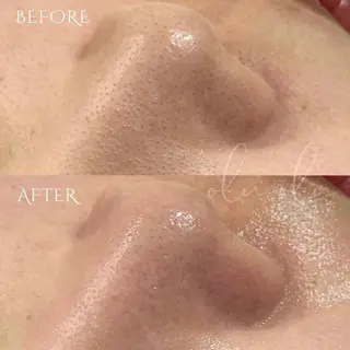 〈医療提携/毛穴・シミケア専門店〉 'Olu'Olu【オルオル】所属・'Olu'Olu シミ・毛穴専門サロンのエステ・リラクイメージ