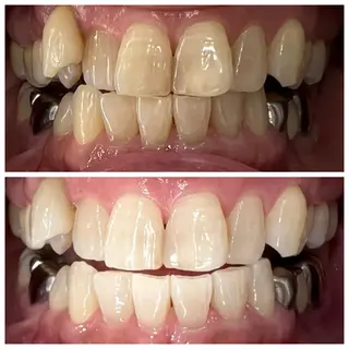 ホワイトニング🦷 ネイル💅LEAのその他イメージ