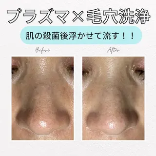 earth龍ヶ崎/ 脱毛/シミ取り🆕のエステ・リラクイメージ