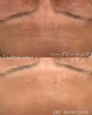 毛穴改善サロン d'Alba大阪住吉のエステ・リラクイメージ