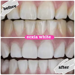 エクシア ホワイトニング日本橋のその他イメージ