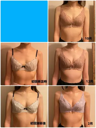 バストアップサロン Feerie：フェリのエステ・リラクイメージ