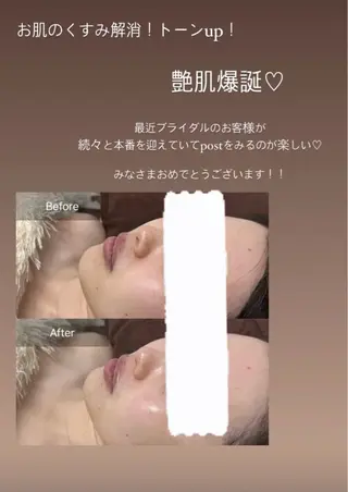 天使の艶肌　REVIハーブピーリング＆ヘッドスパ 武蔵小杉店所属・天使の 艶肌のエステ・リラクイメージ