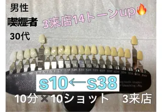 銀座de ホワイトニングのその他イメージ