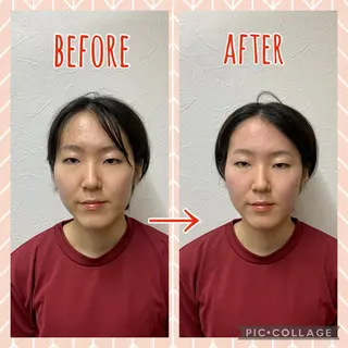 NO.10 整骨院のエステ・リラクイメージ