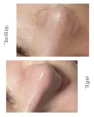 脱毛・肌質改善サロン Linoのエステ・リラクイメージ