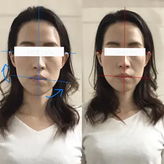 顔の歪み矯正専門 宮内翔のエステ・リラクイメージ