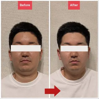 メンズ YUKO ENDOのエステ・リラクイメージ