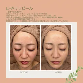 beauty &relaxation lilas所属・菅家 春菜のエステ・リラクイメージ