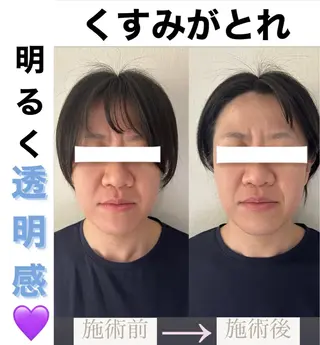 脱毛&美容サロン BLUESEAのエステ・リラクイメージ