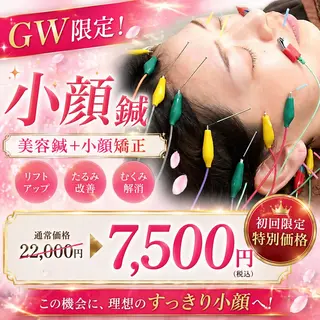 【美容鍼・小顔鍼】 鍼灸師　吉田洋美のエステ・リラクイメージ
