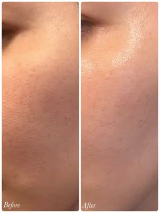 SPA&BEAUTY Shanaのエステ・リラクイメージ