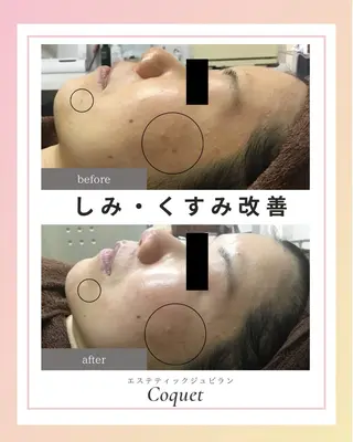 エステティックジュビランCoquet所属・ジュビラン Coquetスタッフのエステ・リラクイメージ