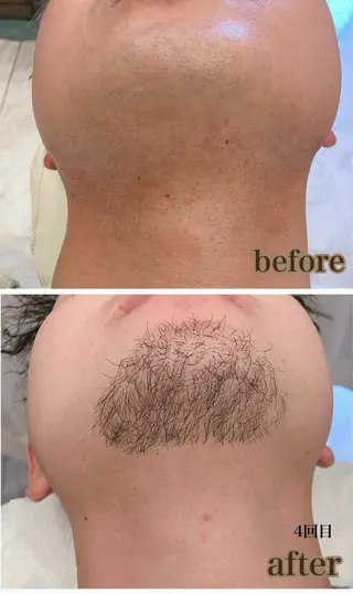 Infinity -Kayo-のエステ・リラクイメージ