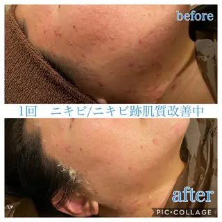 ロング カラー パーマ メンズ Ensor Clair所属・EnsorClair 代表 野口真央のエステ・リラクイメージ