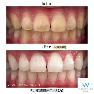 メンズ ホワイトニングショップ桜木町店所属・ホワイトニング ショップ桜木町店のその他イメージ