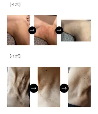 伊藤 稚菜のエステ・リラクイメージ