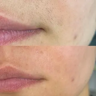 Lam..肌質改善 専門 女性専用サロンのエステ・リラクイメージ