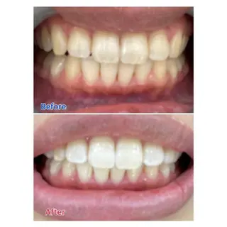 M渋谷店所属・M渋谷 ホワイトニングのエステ・リラクイメージ