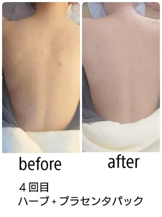 Non ビューティサロンのエステ・リラクイメージ