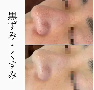 ハーブピーリング専門 BIOPLUS+川崎のエステ・リラクイメージ