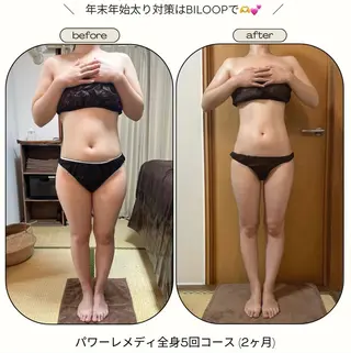 《本気痩せ×疲労改善 》  BILOOPのエステ・リラクイメージ
