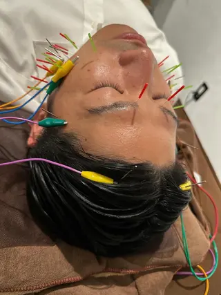 小顔矯/美容鍼/鍼灸 BeauJuのその他イメージ