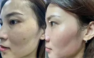 ネイル aliaハーブ水光店 エステティシャン募集のエステ・リラクイメージ