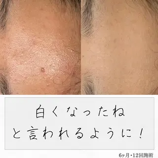 ニキビ経験者が施術 する専門サロン🌻のエステ・リラクイメージ