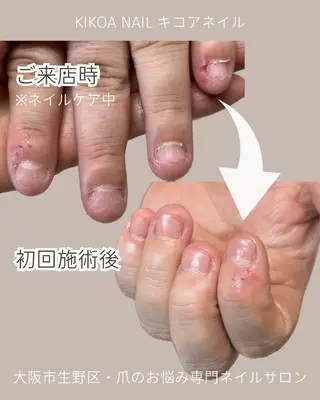 ネイル KIKOA NAIL キコアネイルのネイルデザイン