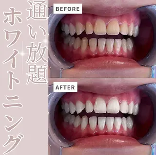 セルフホワイトニング エクシア伊勢店のその他イメージ