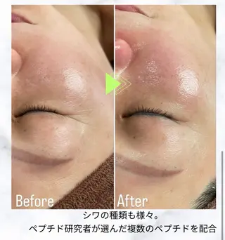 〈etre〉トータルビューティーサロン所属・etre - 韓国肌管理 -のエステ・リラクイメージ