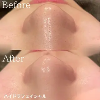 Belle原宿所属・佐藤 加奈のエステ・リラクイメージ