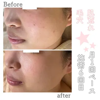 ロング カラー パーマ ヘアアレンジ メンズ キッズ ネイル マツエク・マツパ アイブロウ ニキビ&跡改善サロン オーナー光木のエステ・リラクイメージ