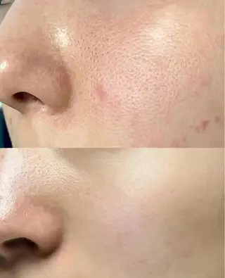 マツエク・マツパ aliaハーブ水光店 エステティシャン募集のエステ・リラクイメージ