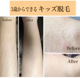 キッズ miilove 鹿児島店のエステ・リラクイメージ