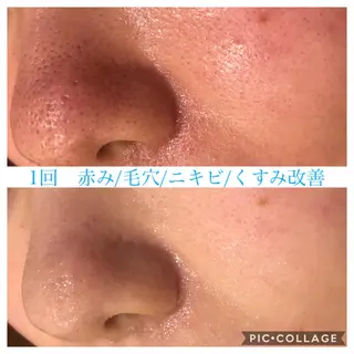 ロング カラー パーマ ヘアアレンジ メンズ キッズ ネイル マツエク・マツパ EnsorClair 代表　野口真央のエステ・リラクイメージ